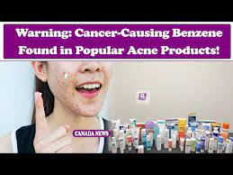 Warning: Cancer-Causing Benzene Found in Popular Acne Products!