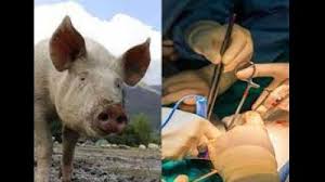 Genetically modified Pig Kidney Transplant ਪ੍ਰਾਪਤ ਕਰਨ ਵਾਲੇ ਪਹਿਲੇ ਵਿਅਕਤੀ ਦੀ 2 ਮਹੀਨਿਆਂ ਬਾਅਦ ਮੌਤ